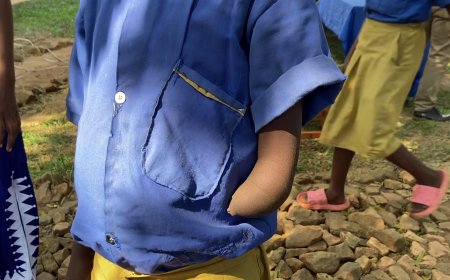 Kirehe: Abana bafite  ubumuga bahangayikishijwe no kwitwa amazina abatesha agaciro