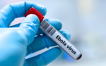 Mu  Bufaransa hagaragaye Umurwayi wa Mbere wa Ebola .